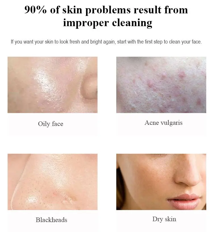 acne vulgaris face wash