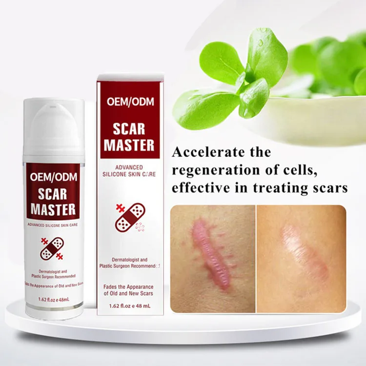 cream to remove eczema scars