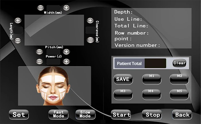 2021 New Face Lifting Medical 12 Line 4D Hifu Body Slimming Machine