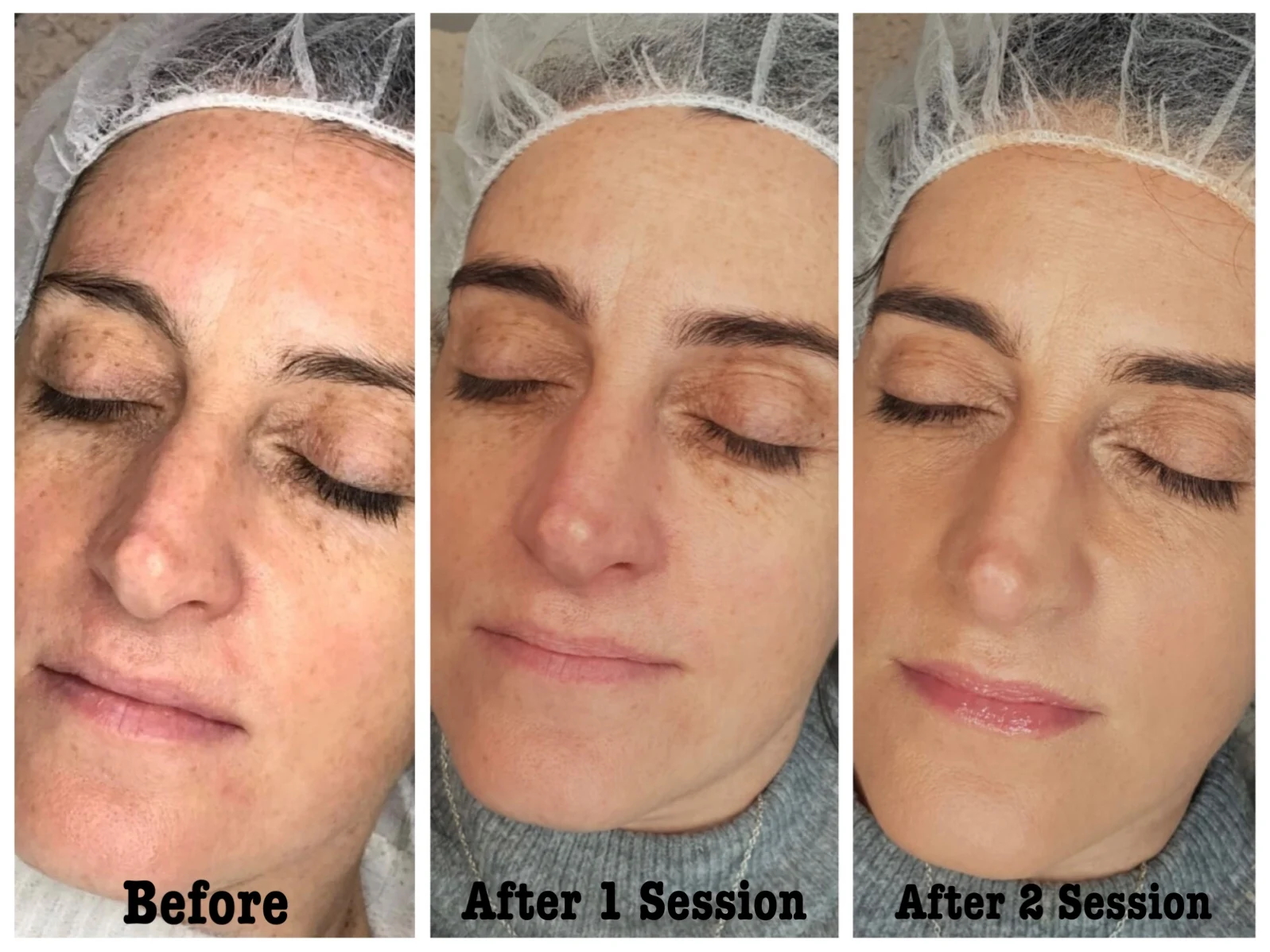 bb glow facial near me