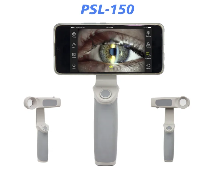 Gilras PSL-150 Portable Slit Lamp 6.5X Magnification for Mobile Eye ...