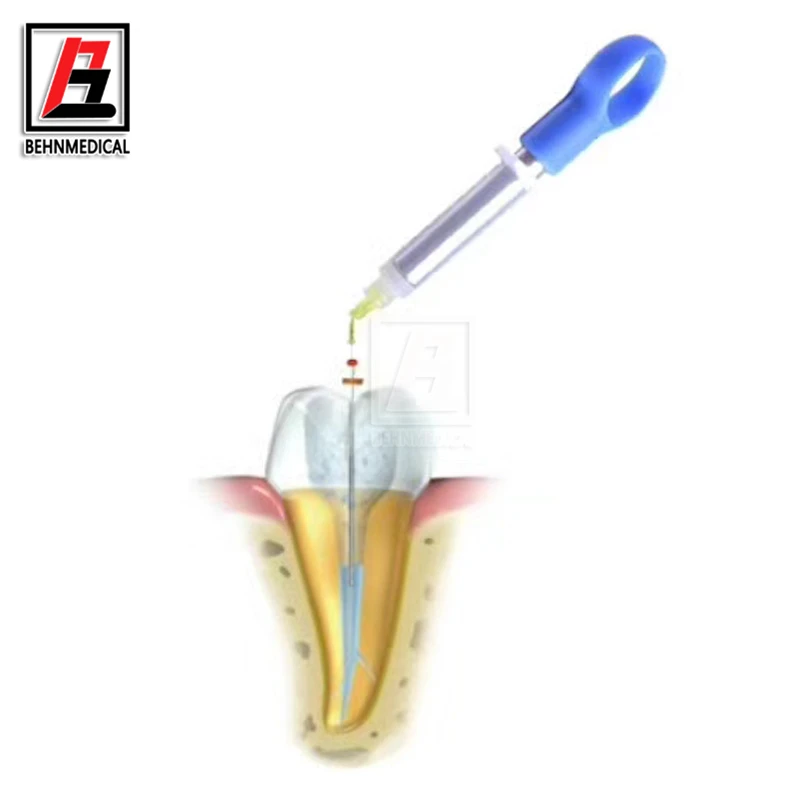 Dental Ultrasonic Negative Pressure Irrigation System Dental Ultrasonic