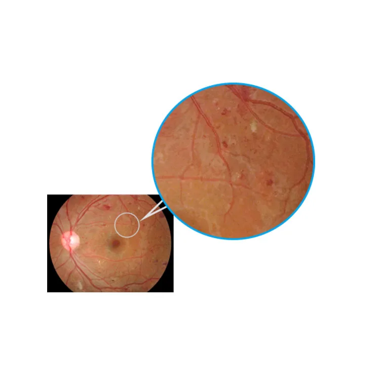 
High Quality Kanghua Angiography CE fundus camera fluorescence For Ophthalmology 
