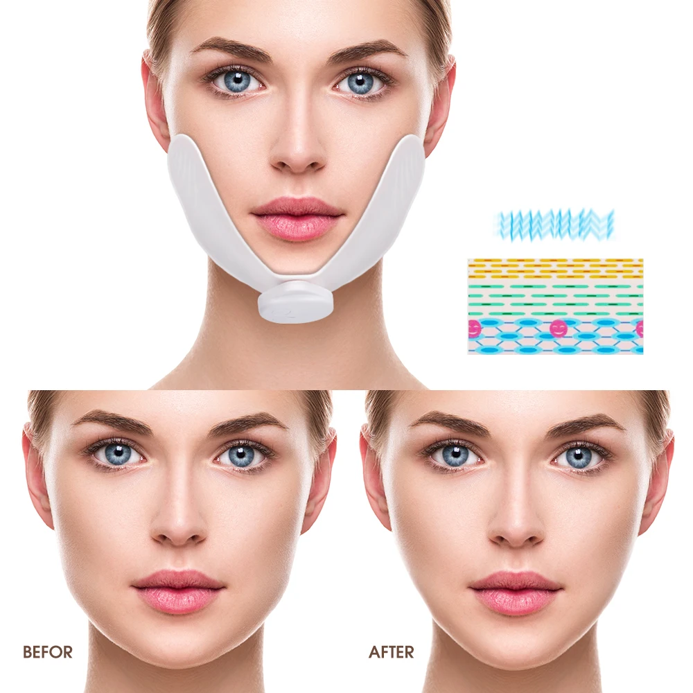 Hailicare Wholesale Slimming v Shape face ems mini rf vibration face ems facial massager.jpg