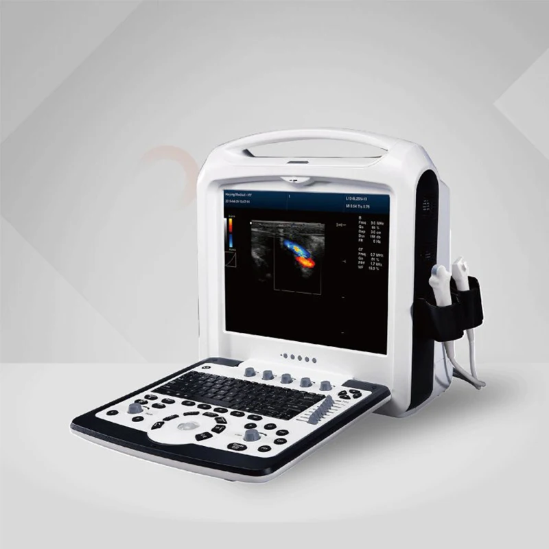 
Hospital medical ultrasound instruments veterinary portable ultrasound scanner 