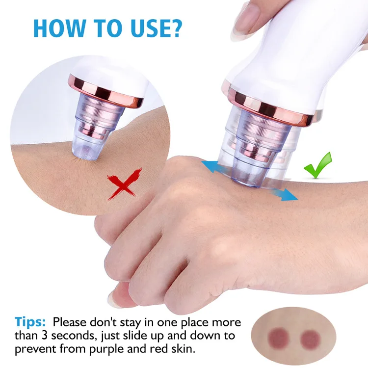 Blackhead remover vacuum