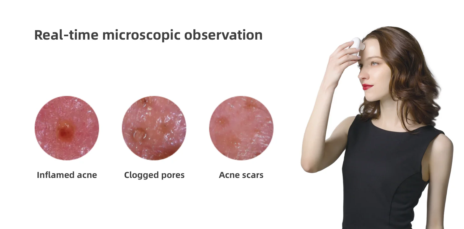 Portable dermatoscope skin detector skin hair analyzer for home and commercial use