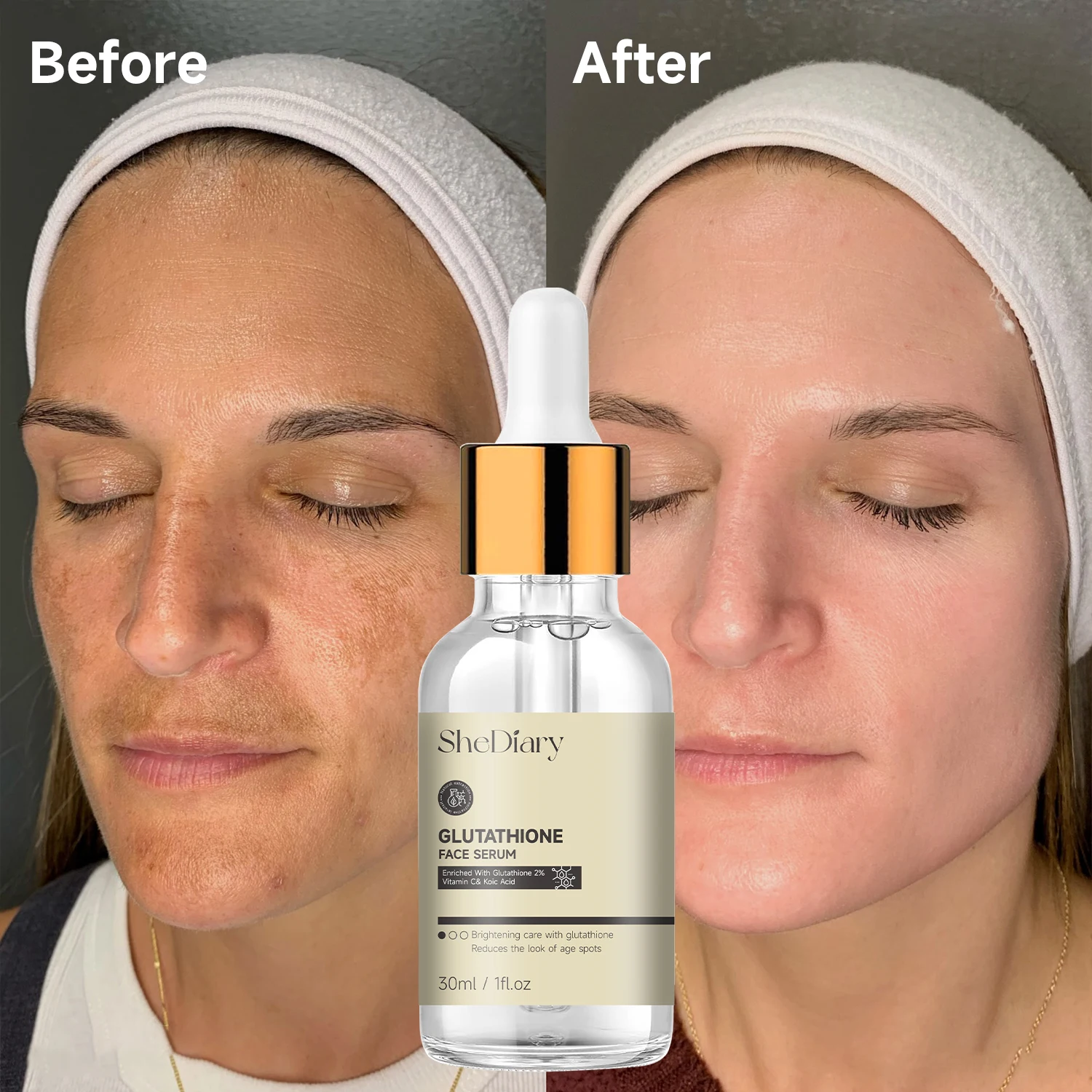 Private Label Glutathione Whitening Freckle Serum Remove Melasma Dark Spots Face Whitening Serum With Vitamin C Kojic Acid