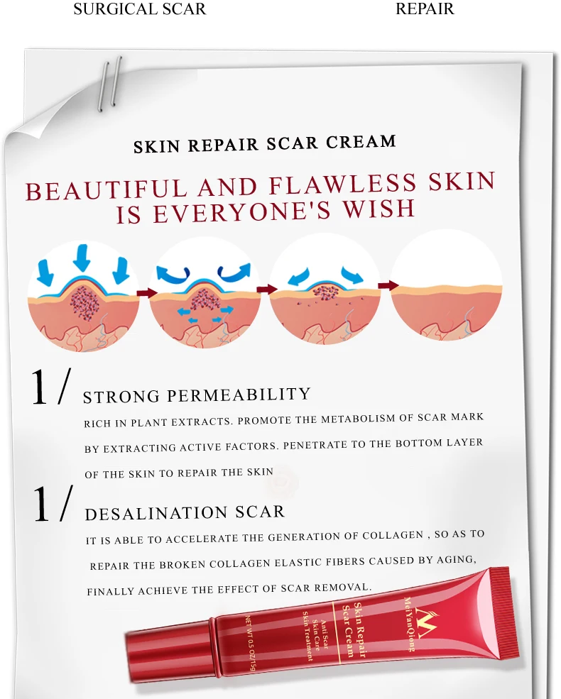 霜皮肤修复面霜痤疮斑点痤疮治疗黑头美白霜抗疤痕妊娠纹 - buy skin