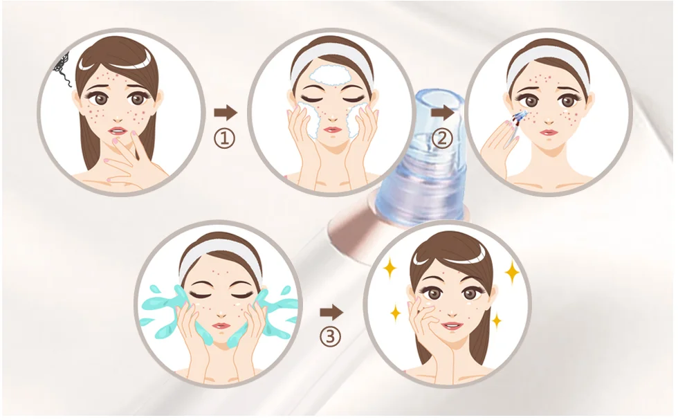 Blackhead remover vacuum