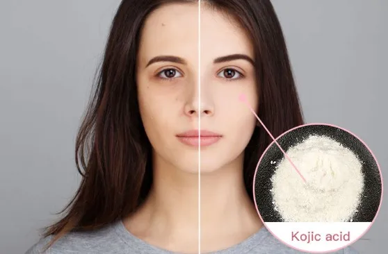 kojic acid.JPG