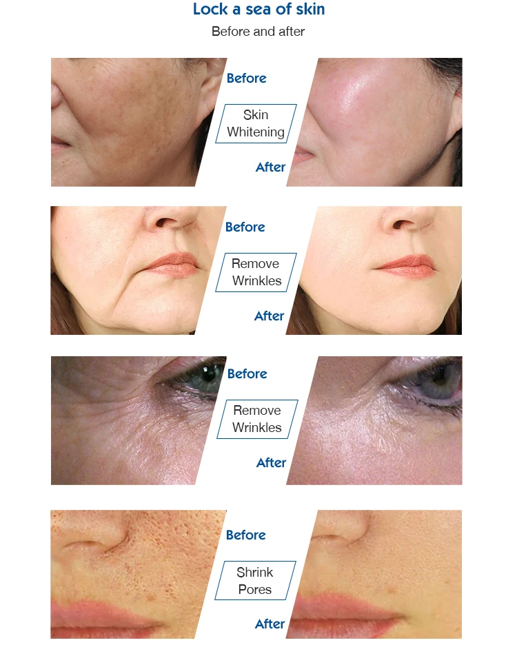 anti wrinkle machine (5).jpg