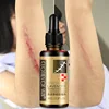 Pregnancy Stretch Mark Removal Essential Oil Effective Maternity Natural Repairing Oil Maternity Relieve Fat Grain Skin Care
