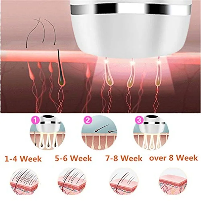 Painless Hair Removal (3).jpg