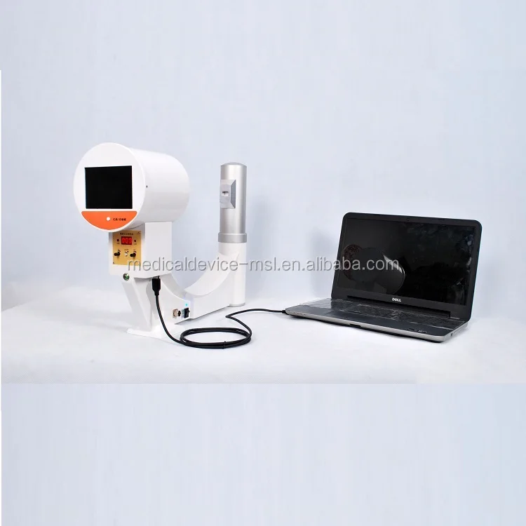 Ce Approved Portable Digital Floroscope X Ray Machine,Portable ...