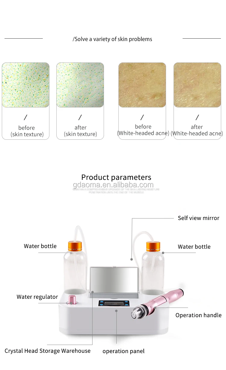 Hydrogen Oxygen Small Bubble Hydra Skin Peel Facial Equipment H2O2 Small Bubble Facial Beauty