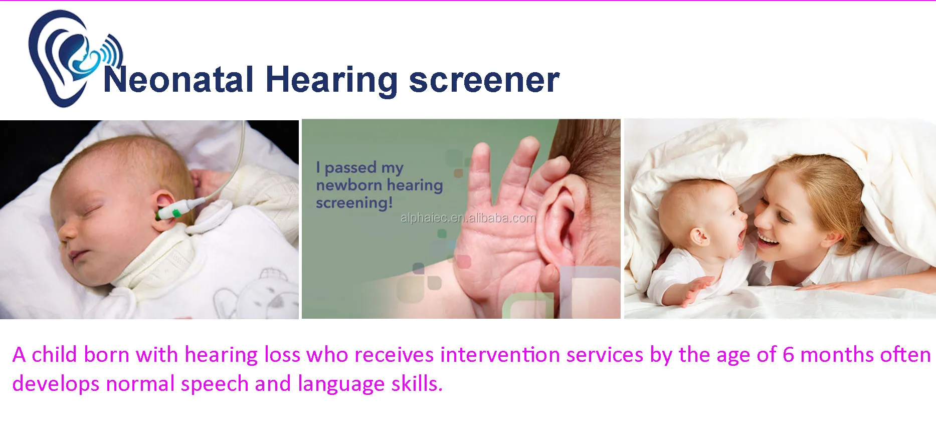 0.986000hz Dpoae And Teoae Infant Oae Hearing Screener For Newborn