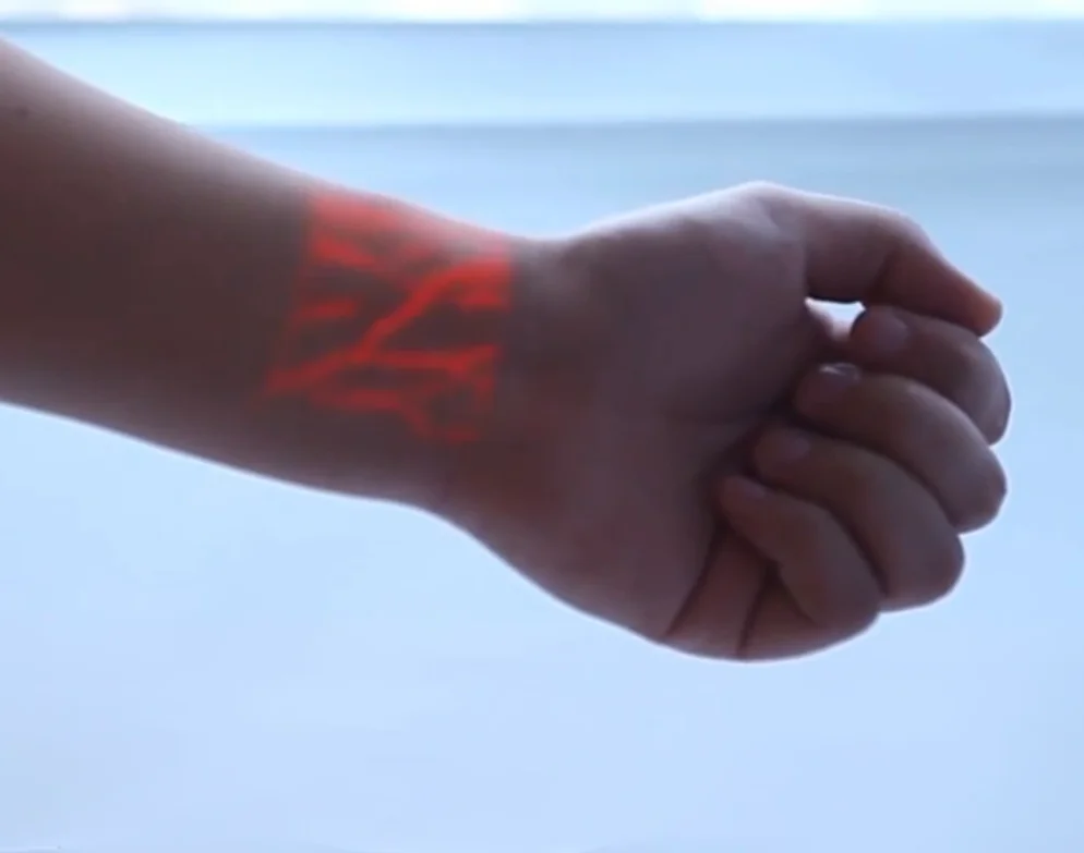 wrist.PNG