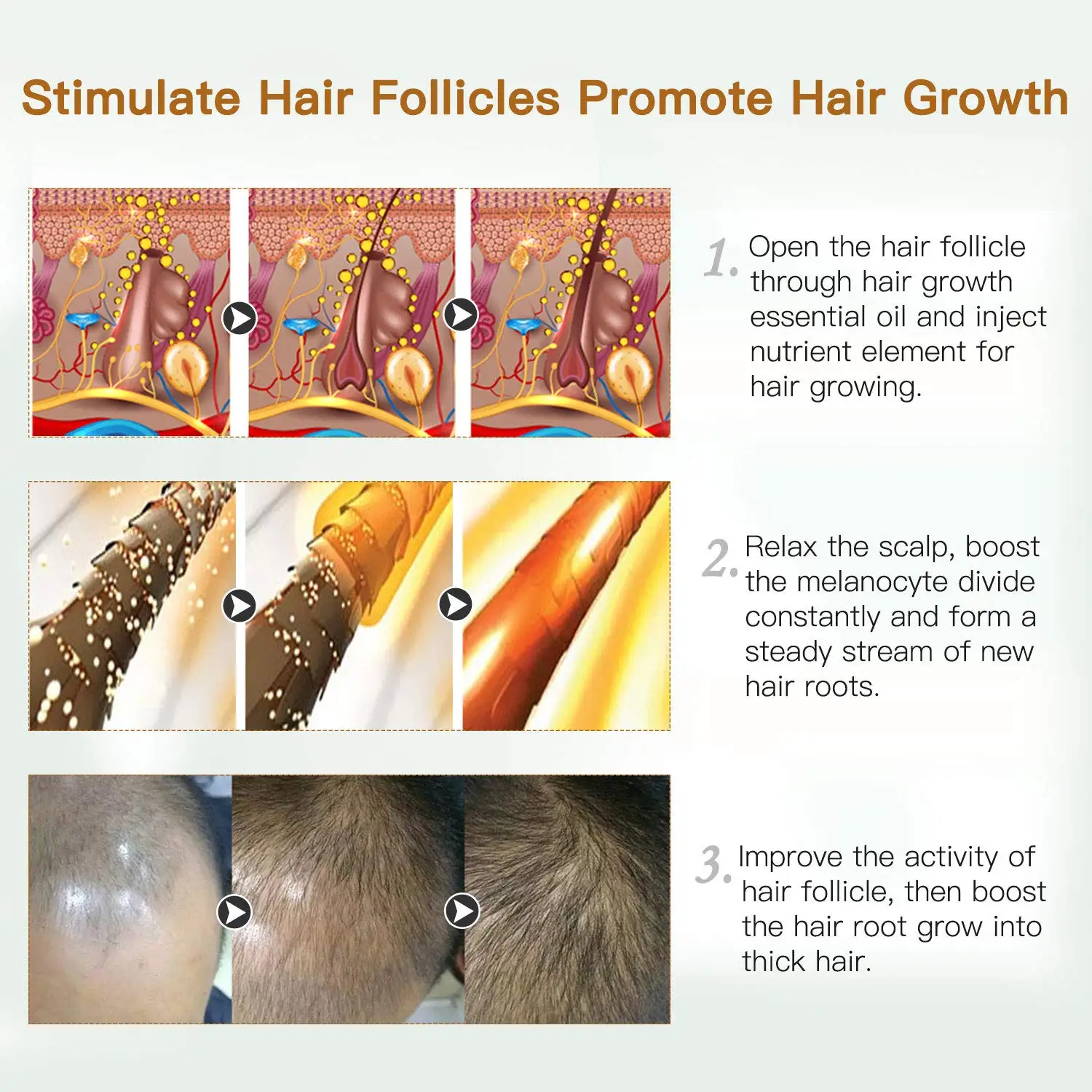 Private Label Ginger Extract Hair Growth Serum Loss Hair Treatment For Hair  Repair Care - Buy Hair Loss Serum Growth,Repairs Hair Follicles  Serum,Ginger Extract Serum For Hair Treatment Product on 