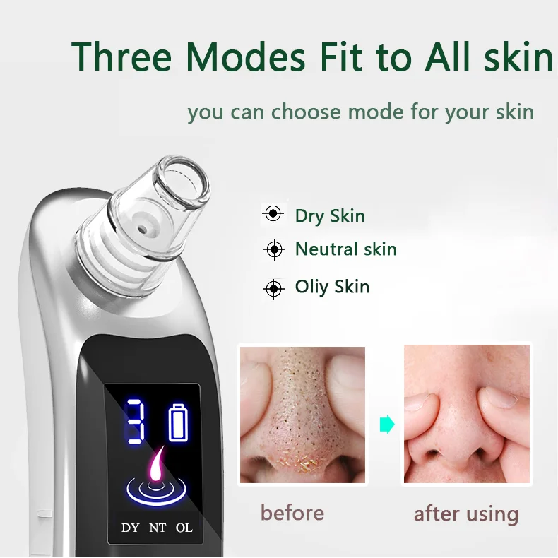 Blackhead Remover Vacuum Blackhead Removal Peel Tool Extractor Electric