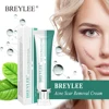 BREYLEE Acne Scar Removal Cream 30g Face Cream Skin Repair Skin Care Scar Acne Treatment Remove Stretch Marks Whitening Cream