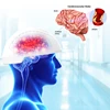 2019 Brain Photobiomodulation 810nm Infrared light therapy Machine