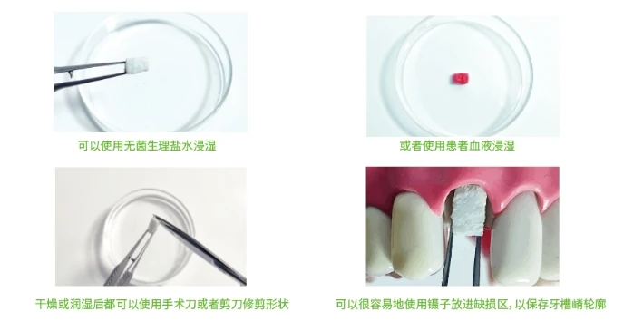 disposable Biodegradable Collagen Membrane Dental absorbable sponge Can be customized details