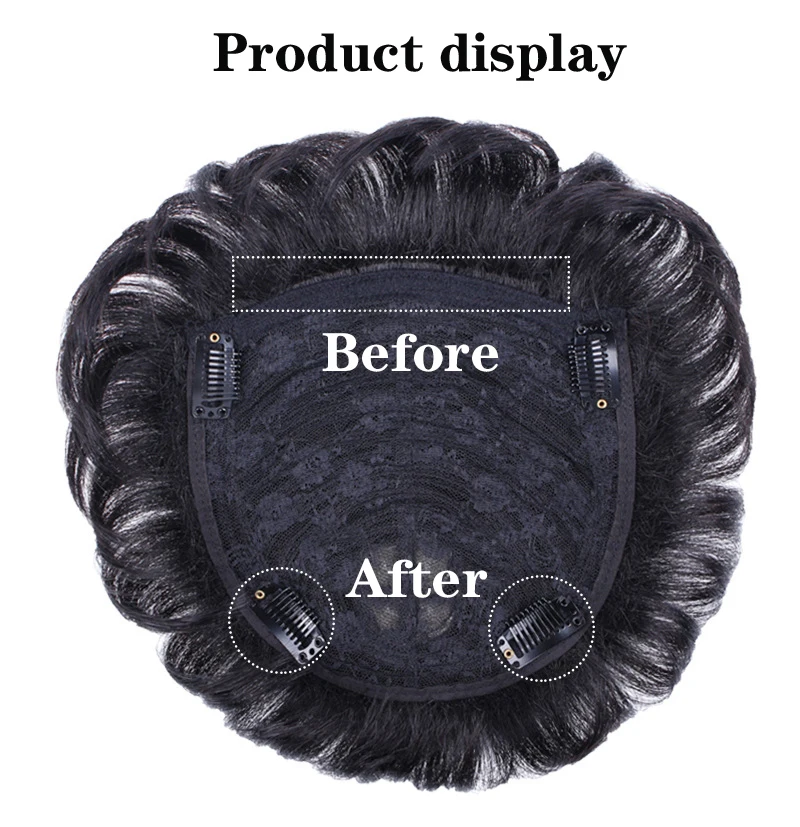 Replace hair on top man7 .jpg