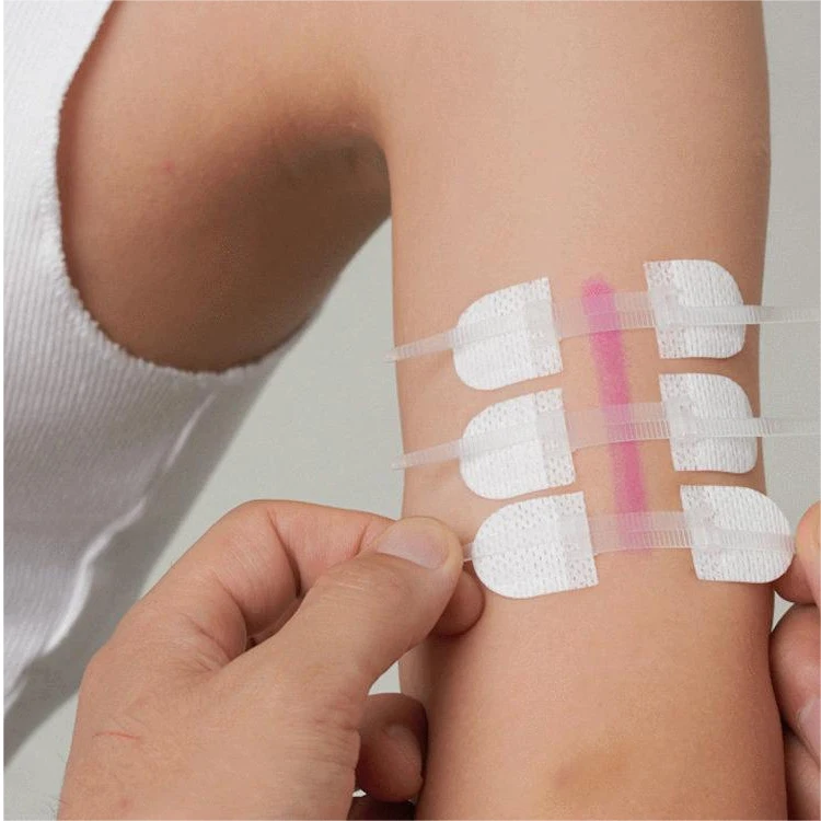3 Pieces/set Zipper Bandaid Wound Closure Patch Hemostatic Patch Wound Fast Suture Zipper Band