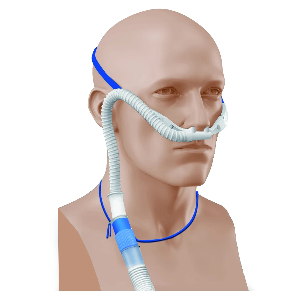Nasal Cannula Oxygen Tube High Flow Hfnc Oxygen Tube Oxygen Therapy Buy Nasal Cannula Oxygen Therapy Hfnc Product On Alibaba Com