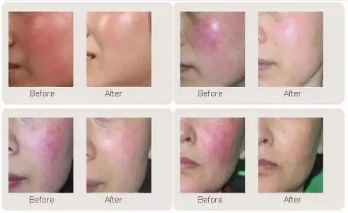 Before and after.JPG