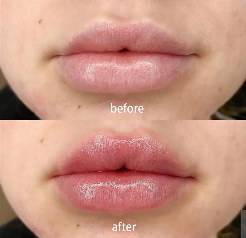 High Quality Lip Plump Enhancer Plumper Capsicum Frutescens Fruit Lip