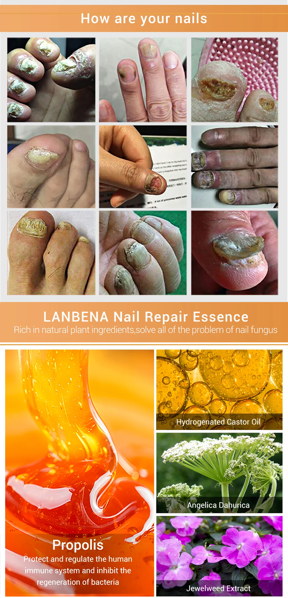 Lanbena Nail Repair Essence Serum Fungal Nail Treatment Remove 