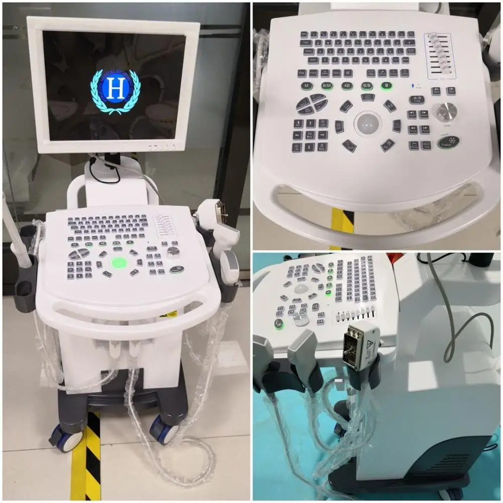 HBW-10 Plus Plus តម្លៃវេជ្ជសាស្រ្តដែលមានតម្លៃប្រកួតប្រជែងដែលមានតម្លៃពេទ្យស្កេនម៉ាស៊ីនស្កេនអ៊ុលត្រែលីចល័តតាមឌីជីថលឌីជីថល