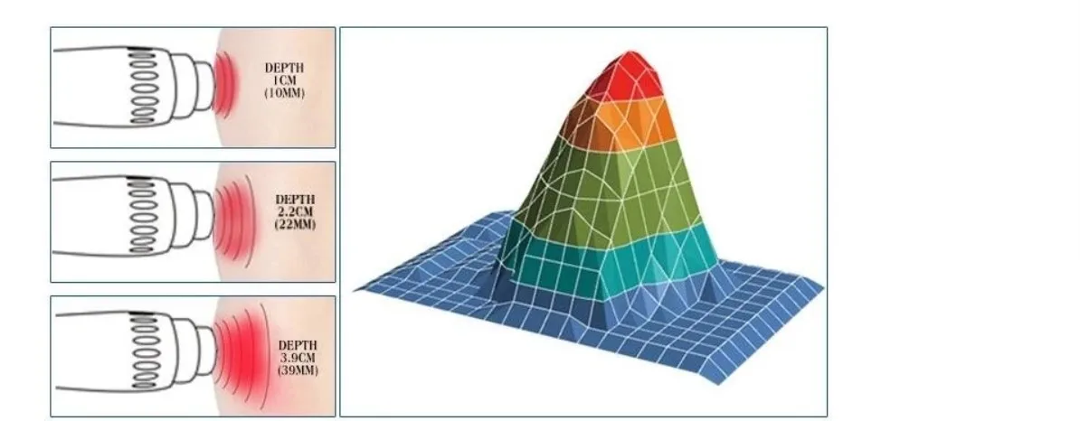 shock ed 1000 shock wave machine for ed / for erectile dysfunction