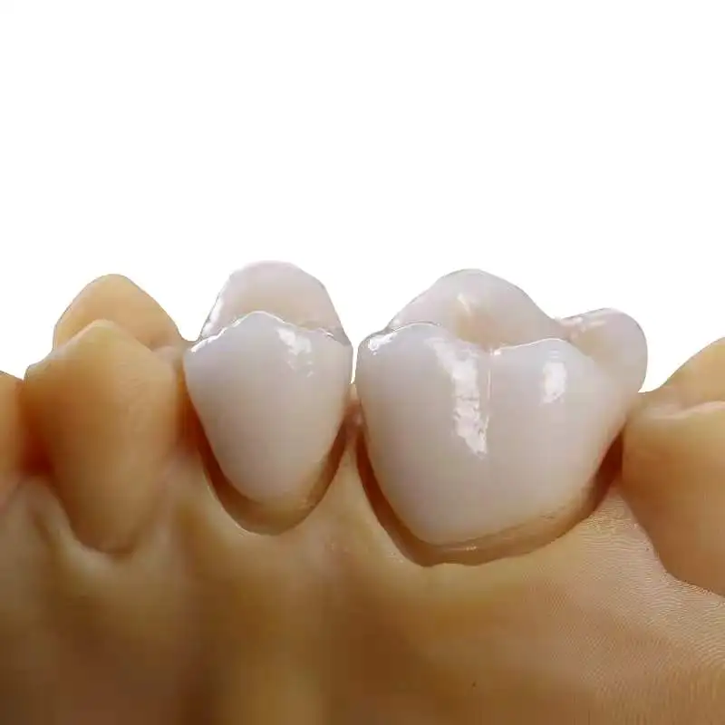 dental factory reasonable price porcelain teeth dentures