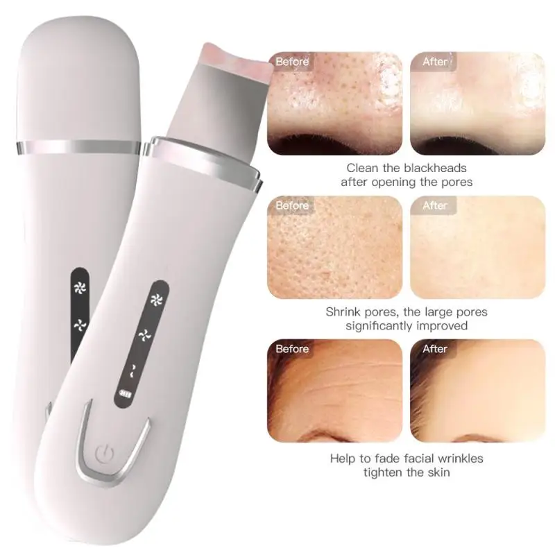 Multi-functional Facial Lifting Ultrasonic Facial Skin Scrubber For Commercial &amp; Home Use