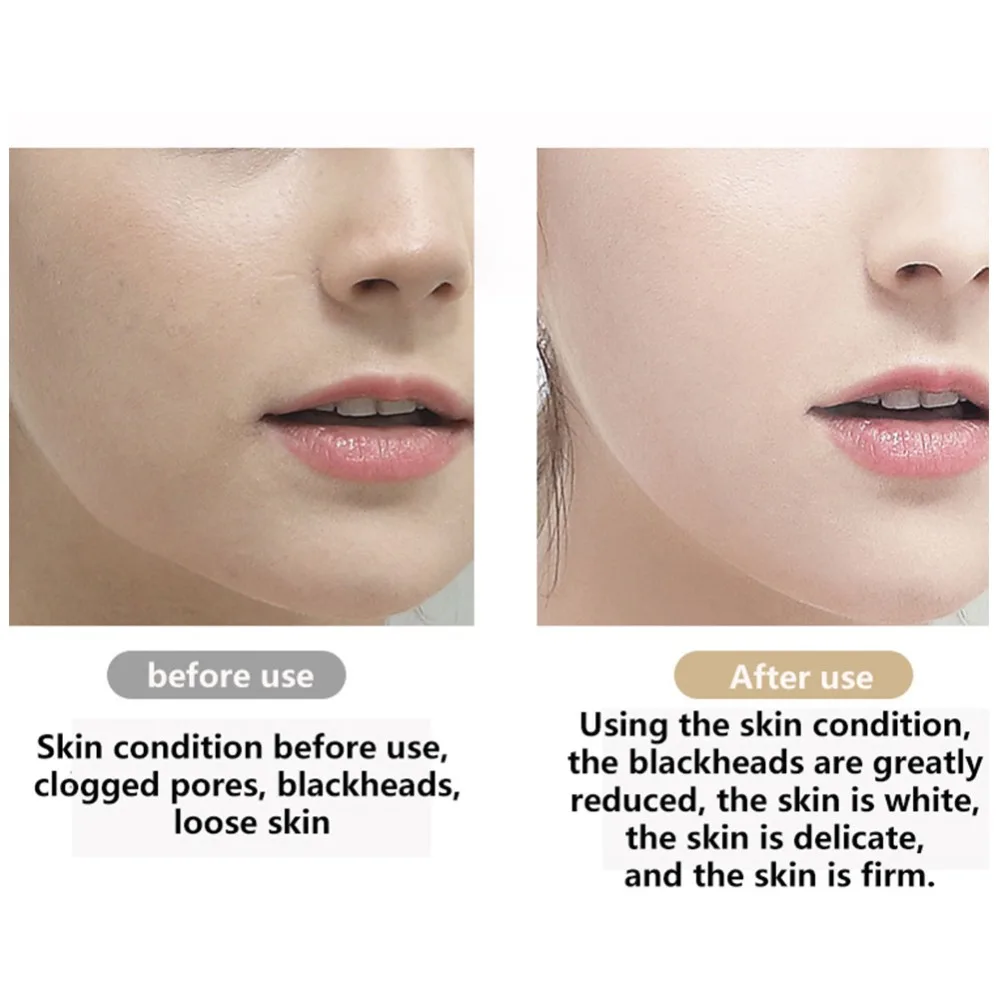 Skin scrubber-2 (3).jpg