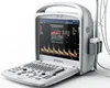 Best-selling hot sale of high quality 2D Portable Color Doppler Ultrasonic Diagnostic System