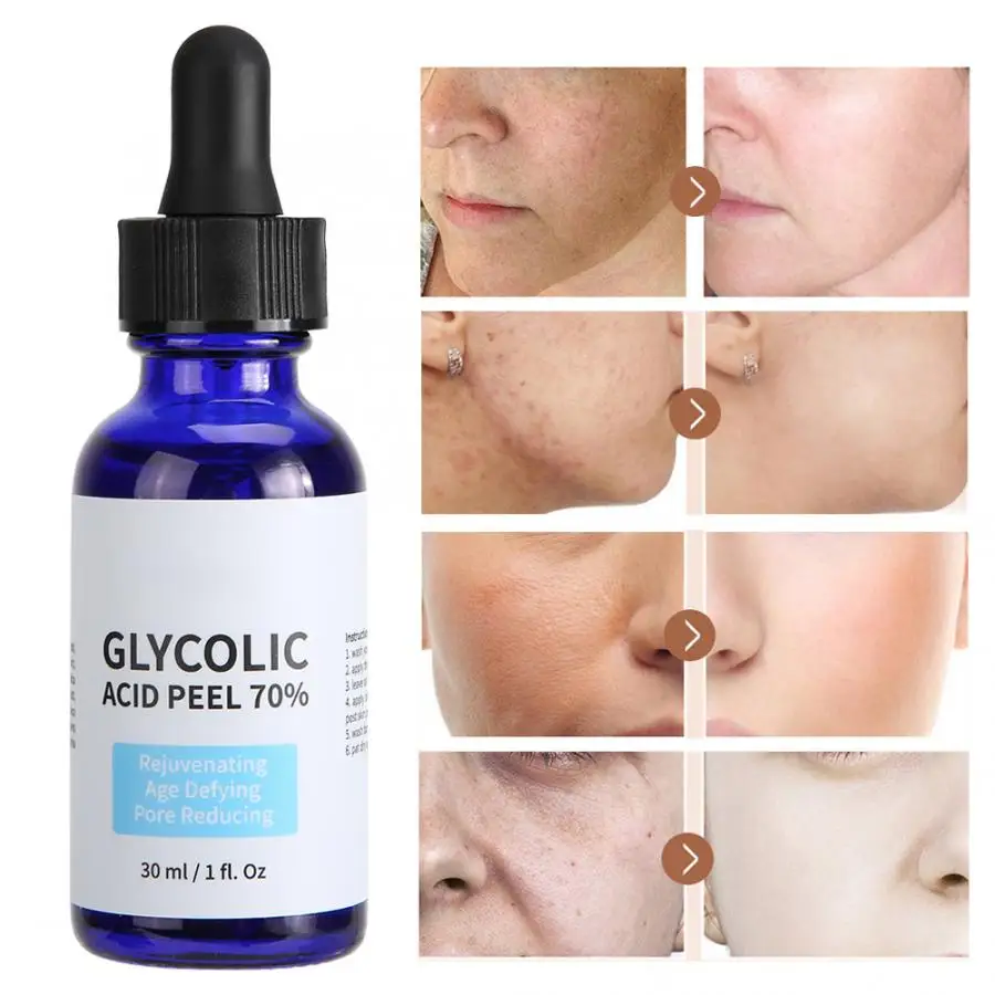 Wholesale 30ml Solution Glycolic Acid 70 Peel Serum Reduce Pores ...