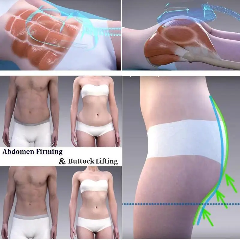 Emsculpt отзывы до и после Профессиональный 2 ручки/4 ручки emslim nova rf Ems мышечный Стимулятор Tesla em