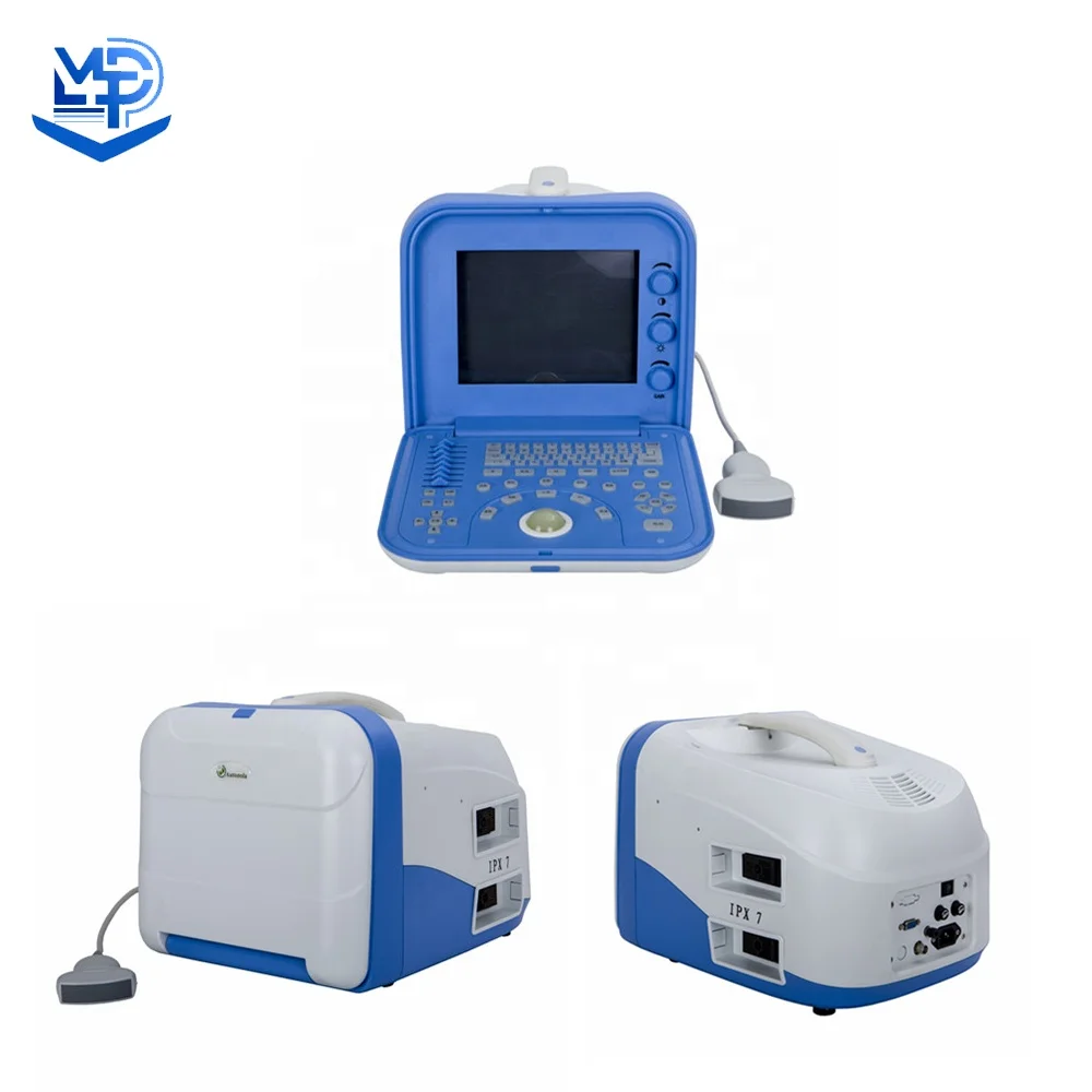 Full Digital Portable Ultrasound Scanner Medical Ultrasound Instruments  machine uptodate medical details