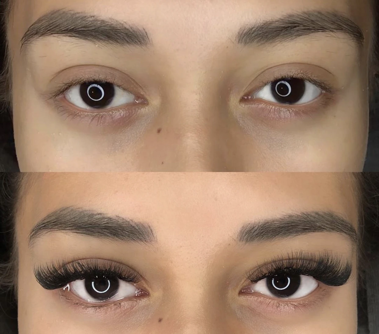 before and after