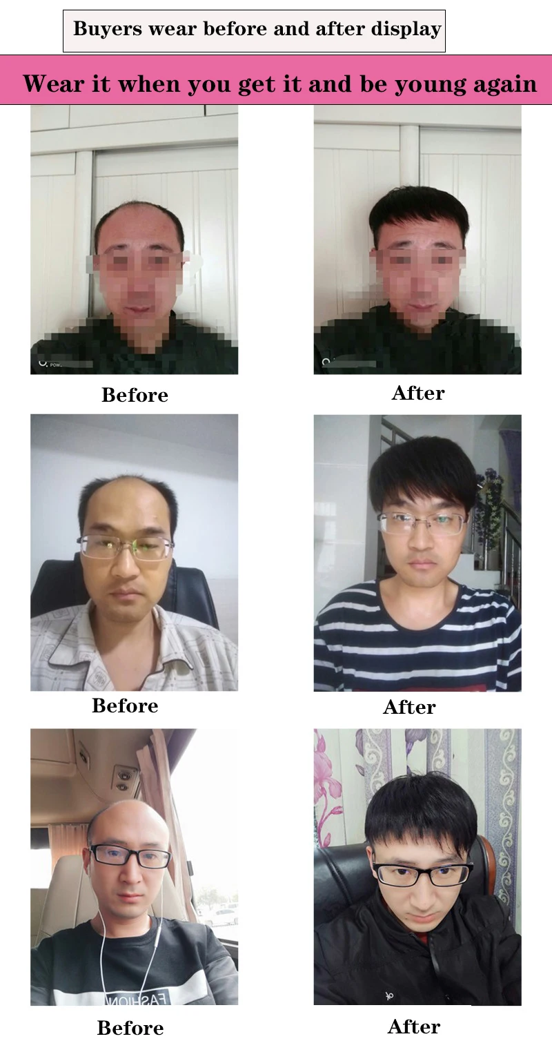 Replace hair on top man .jpg