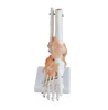 The model of ankle joint