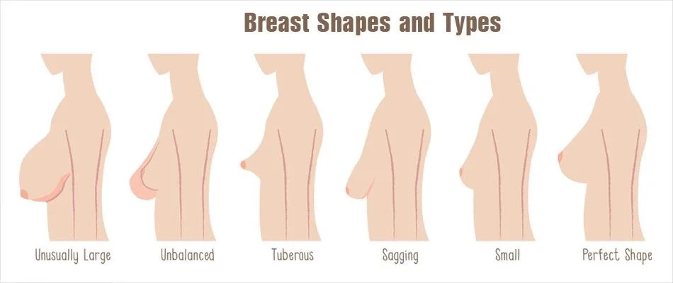 breast and buttocks enlargement medical care hyaluronic acid