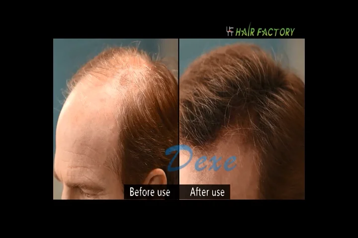 Кератиновые Волокна Для Волос Купить