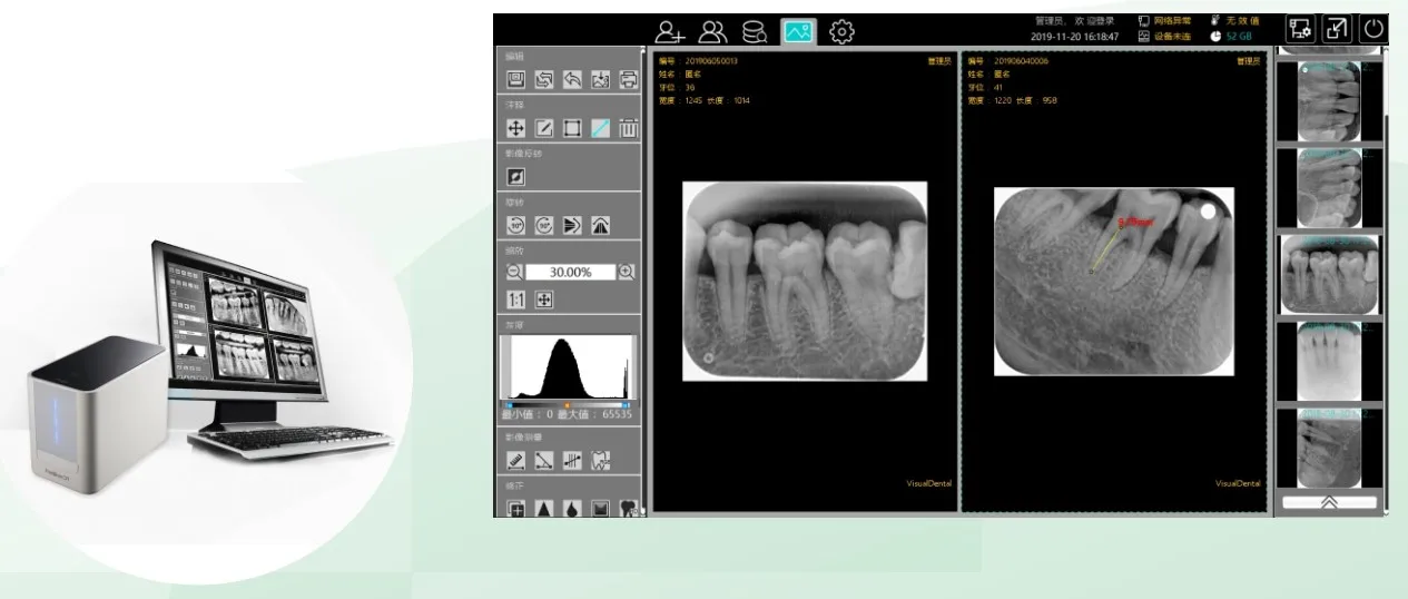Cr100 Dental Image Plate Scanner X Ray Reader Dental Intraoral Cr Imaging Plate Scanner X Ray