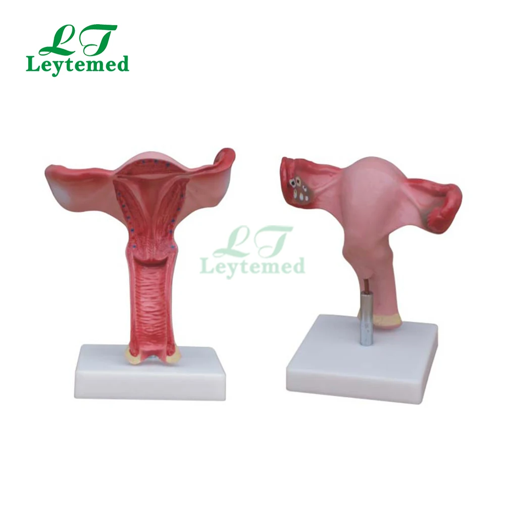 xc-436a 医学解剖人类塑料模型子宫