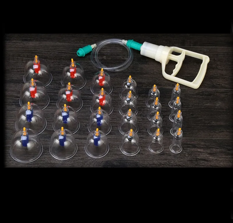 cupping set.jpg